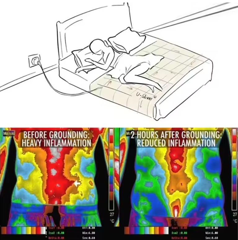 ZenGrounding™ Bedsheet
